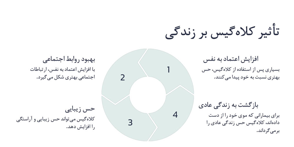 تصویر اینفوگرافیک درباره تاثیز کلاه گیس در زندگی افراد