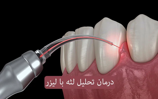جراحی جراحی | درمان