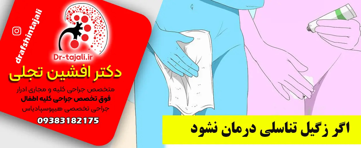 درمان زگیل تناسلی | زگیل تناسلی