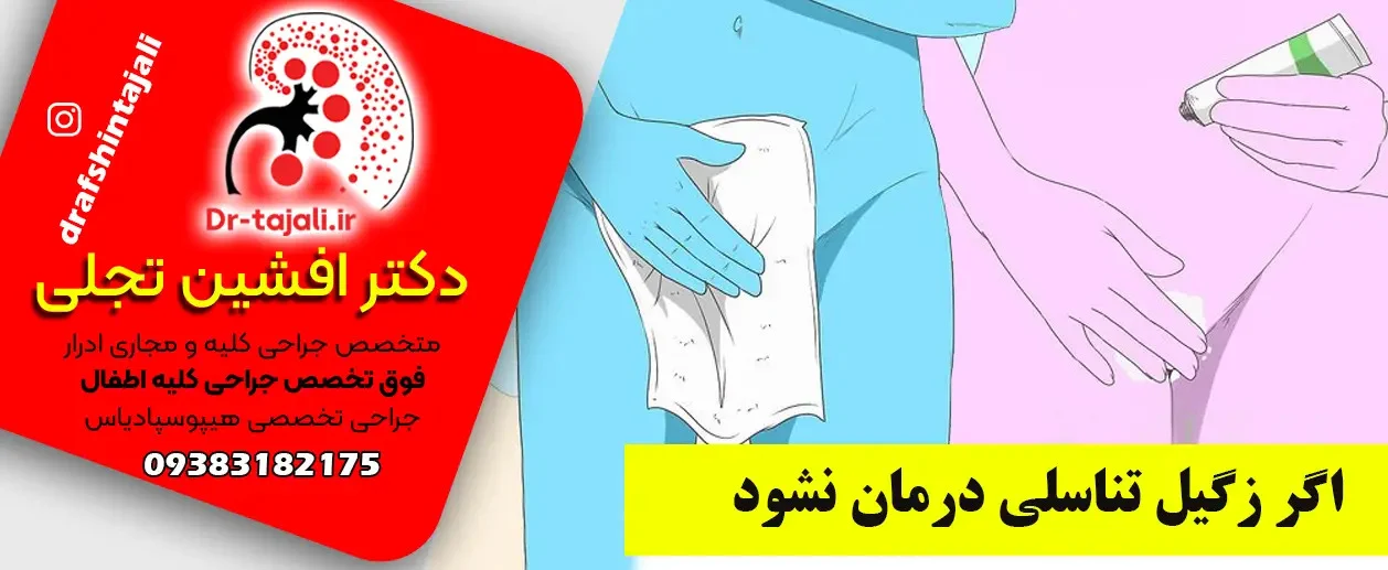 درمان زگیل تناسلی | زگیل تناسلی