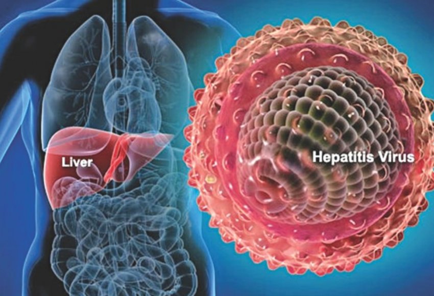 هپاتیت منجر به ناباروری در مردان و زنان می شود - خبرگزاری مهر | اخبار ایران و جهان