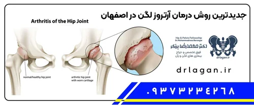 درمان خانگی