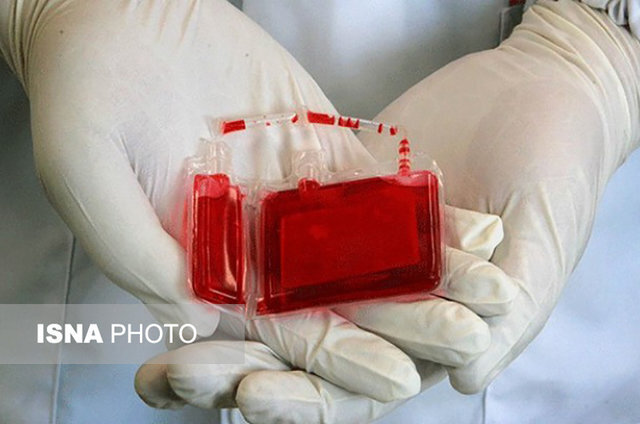 پیوند خون بند ناف از بانک سازمان انتقال خون به کودک ۵ ساله