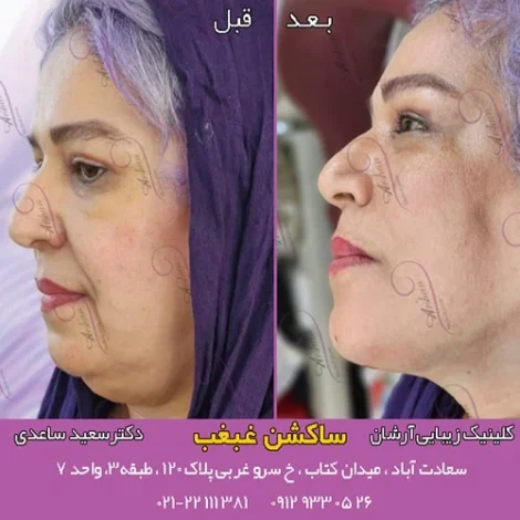 مطالب میجیک