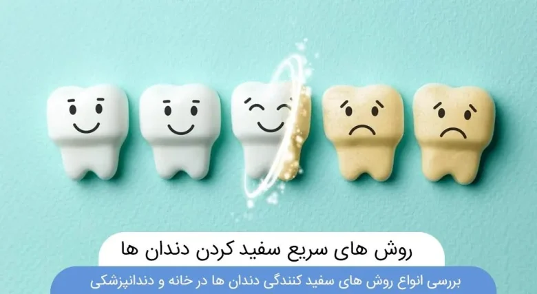 مطالب میجیک مطالب میجیک