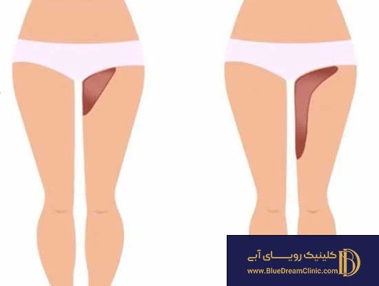 مطالب میجیک