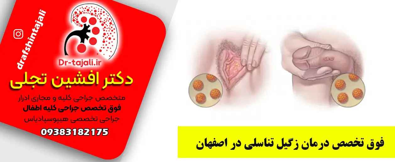 درمان زگیل تناسلی | زگیل تناسلی